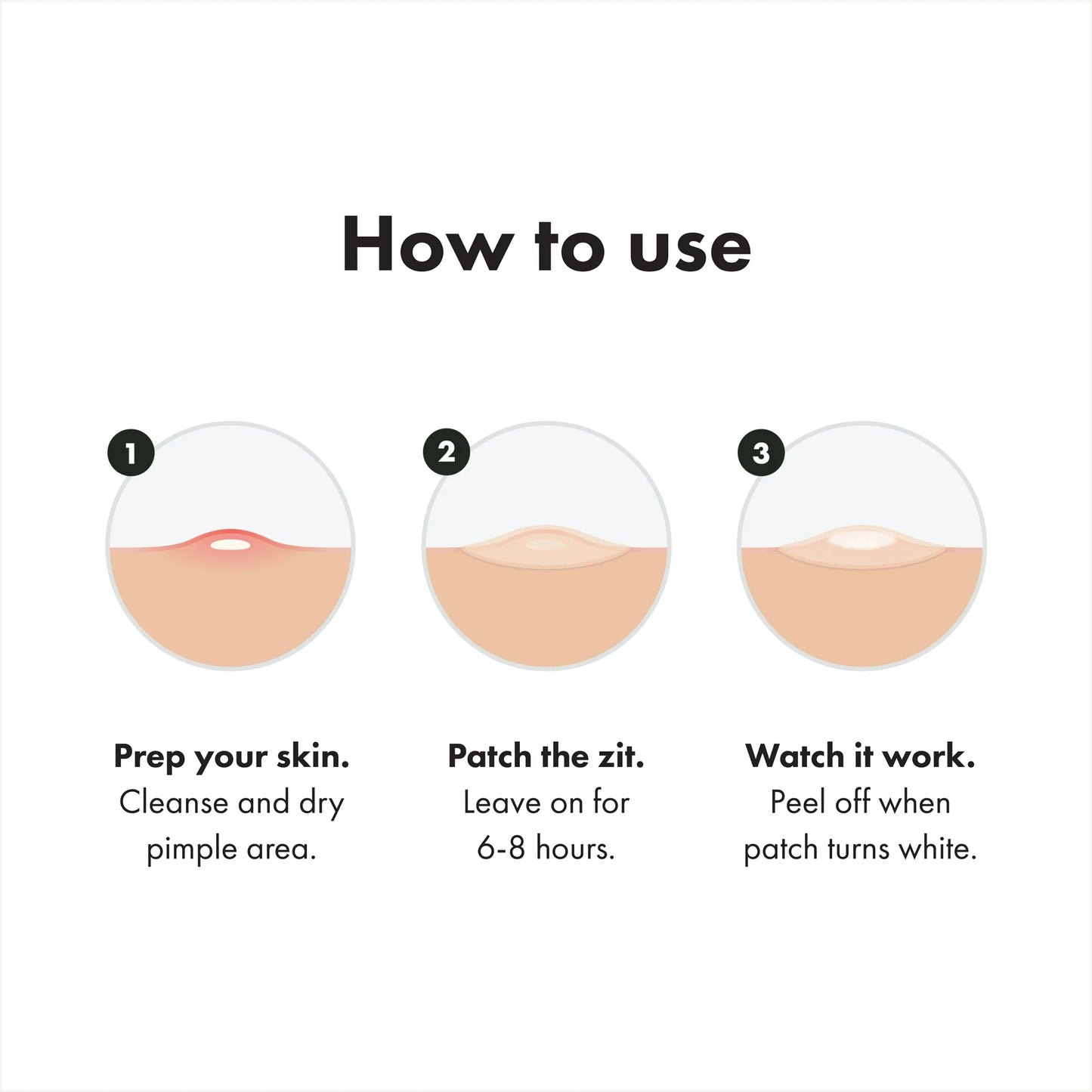 Mighty Patch™ Original patch from Hero Cosmetics - Hydrocolloid Acne Pimple Patch for Covering Zits and Blemishes in Face and Skin, Vegan-friendly and Not Tested on Animals, 72 Patches Per Box, 10 Boxes Total (720 Total Patches)